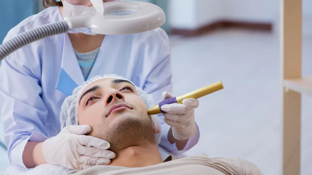 What is laser acne scar treatment เลเซอร์หลุมสิว