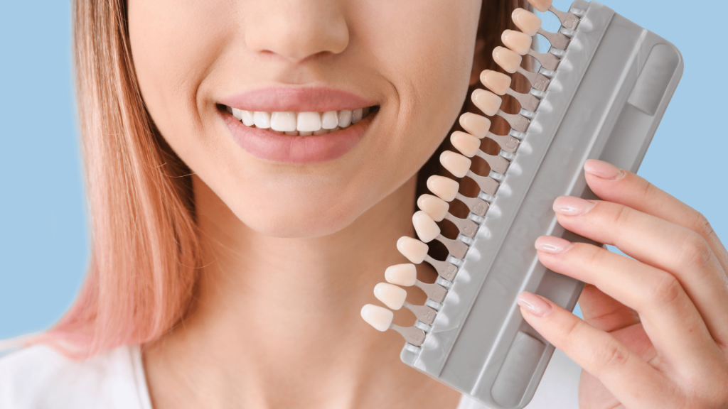 วีเนียร์