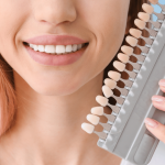 วีเนียร์